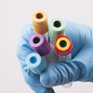 a hand wearing a blue rubber glove clutching five color coded blood vials